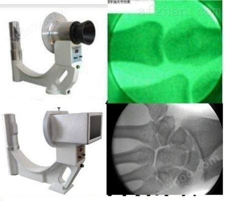 便携式X射线机/手法复位/穿克氏针检视用