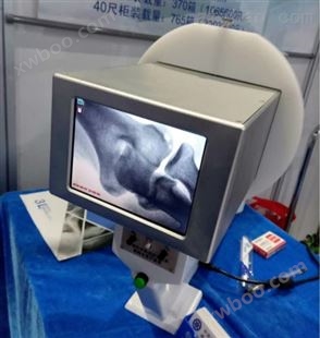 手提式X光机/矫形骨科用便携式X光机
